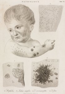 Dermatologi Typer av hudsjukdomar av John Pardon