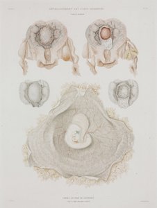 Gynekologi Mänsklig livmoder med embryo, c 1847-1859 av John Pardon