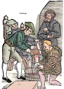 Amputation av ett ben utan bedövning, 1593 av Unbekannt