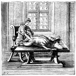 Blodtransfusion från djur till människa, 1679 av Unbekannt