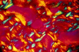 BIO-MATERIAL, LM Ben av Unbekannt