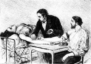 Dr Roussell från Genève gav en kvinna en direkt blodtransfusion från en volontär, 1882 av Unbekannt
