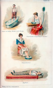 Hydroterapibehandlingar, c1902 av Unbekannt