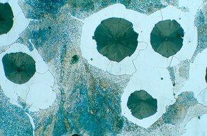 METALLER, JÄRN, LM Sfäroidal grafit segjärn (etsat) av Unbekannt
