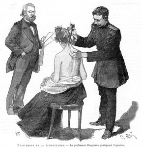 Professor Bergmann injicerar en tuberkulospatient, 1891 av Unbekannt