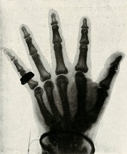 Röntgenbild av handen på H.R.H. Prinsen av Wales, c1897 av Unbekannt