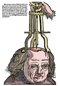 Trephination, 1593 av Unbekannt