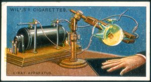 Röntgenapparat, 1915 av Unbekannt