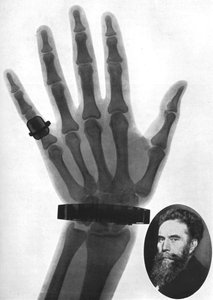 Röntgenfotografi av en hand, 1926 av Unbekannt