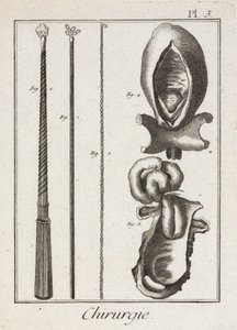 Utrustning, tidigmoderna kirurgiska instrument och diagram över kroppsdelar av Unbekannt