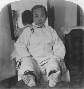 En hög kast damer läckra liljefötter, visar metod för deformitet, Kina, 1900.