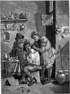 En charlatankirurg på 1700-talet undersöker en axelskada. (Ur en gravering av tiden). Gravyr i "" La Nature: revue des sciences et de leurs applications aux arts et a l