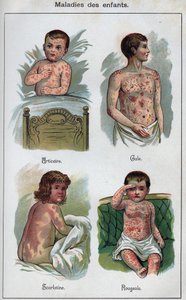Sjukdomar hos barn: Nässelutslag, mässling, skabb, scharlakansfeber. I ”The new natural medicine”” av F.E. Bilz. av Unknown artist