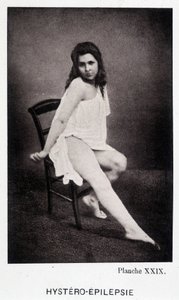 Hystero Epilepsie - Contracture in "" Photographic iconography of the Salpétrière: service of Mr. Charcot" av Paul Regnard och Bourneville av Unknown artist