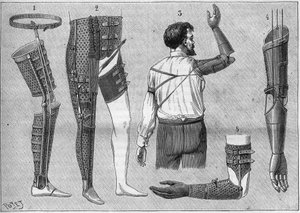 Modern apparat för amputering. 1) konstgjorda ben med bälte, 2) apparat för dearticules låret, 3 och 4 konstgjorda armar uppfunna och byggda av M.L Matthieu för framlidne Roger, 5) konstgjord arm med hand, tumme och pekfinger. i "La nature" från 1888. av Unknown artist