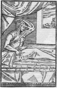 Näsoperation: Rekonstruktionskirurgi på näsan i ”De curtorum chirurgia per insitionem””. Venedig av Unknown artist