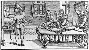 Reduktion av en dislokation, -i "Traité Médical" av Ambroise Paré, cirka 1560. av Unknown artist