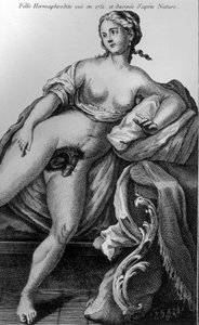 Hermafroditflicka sedd 1751 och hämtad från naturen. av Unknown artist