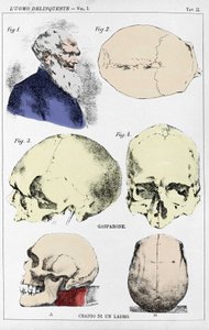 Studie om morfologin hos en brottslig skalle av den italienska kriminologen av Unknown artist