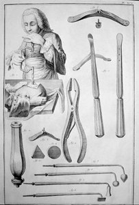 Trepanering av skallen, olika instrument (gravyr av Unknown artist