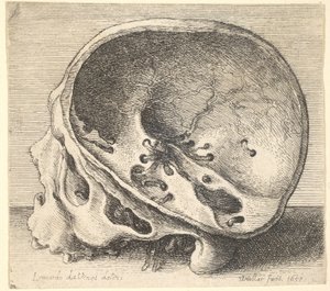 Sektionerad skalle i profil till vänster med vänster sida av kraniet borttagen, 1651. av Wenceslaus Hollar