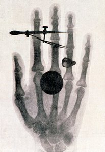 Wilhelm Röntgens röntgenfotografi av sin hustrus hand, 1896 av Wilhelm Conrad Rontgen