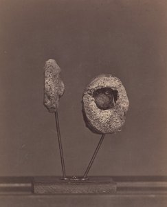 Utskuren knäled. En rund muskötboll i den inre kondylen på höger lårbenet [Gardin..., 1866-67.
