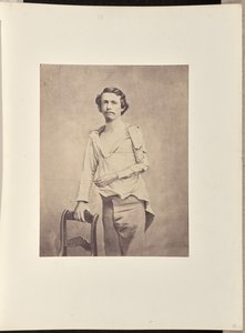 Framgångsrik excision av huvudet på vänster Humerus, följt av nekros och sekundär excision av resten av Humerus och de övre extremiteterna av Radius och Ulna av William H. Bell