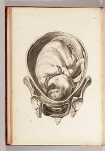 Gravyr av ett barn i livmodern från "En uppsättning anatomiska tabeller, med förklaringar och en förkortning av barnmorskepraktiken", 1754 av William Smellie