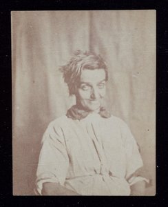 Psykiatri Porträtt av en patient, Surrey County Asylum, ca 1852 av John Pardon