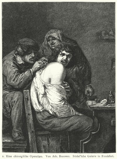 Ryggoperationen av Adriaen (after) Brouwer