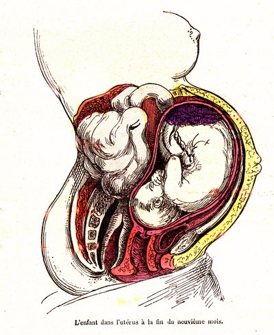 Barnet i livmodern (sen 9:e månaden) - J. Rengades normala liv och hälsa - Ritning A.Demarle 1881 av Alphonse Demarle