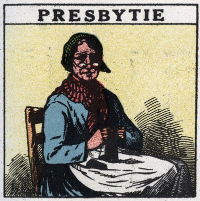 Ögat: person som lider av presbyopi. Anonym illustration från 1925. Privat samling. av Anonymous Anonymous