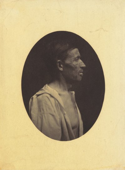 Ett porträtt, sett i profil, av en man 42 år gammal, bedövad av alkoholmissbruk..., 1854-1856. av Duchenne de Boulogne