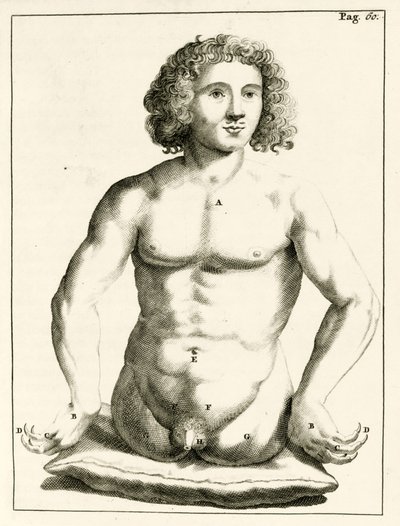 Exempel på medfödda missbildningar av Frederik Dekkers, 1694 av Dutch School