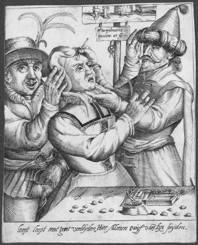 Trepanning, graverad av H. Weydmans (1500-talet) av Dutch School
