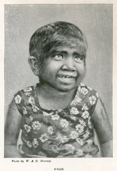 Krao, The Missing Link, utställd på Aquarium, Westminster, London, 1887 av English Photographer