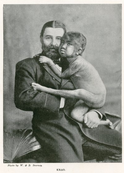 Krao, The Missing Link, utställd på Aquarium, Westminster, London, 1887 av English Photographer