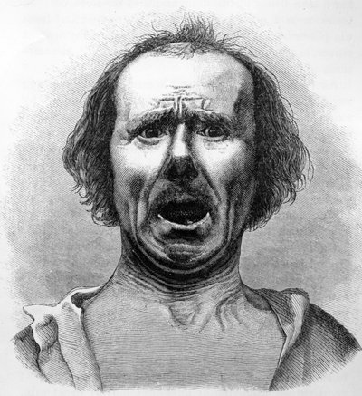 Skräck och ångest, kopierad från ett fotografi av Dr. Duchenne, illustration från 