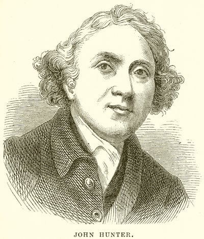 John Hunter av English School