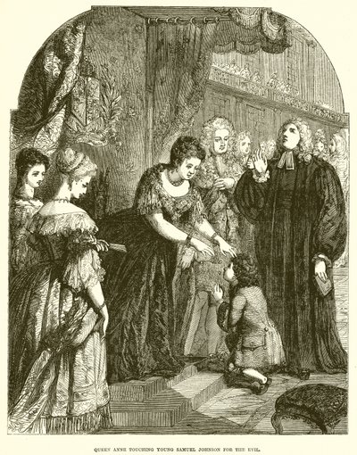 Drottning Anne berör unge Samuel Johnson för ondskan av English School