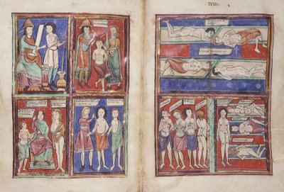 Sloane 1975 fol.91v-92 Medicinska scener av English School