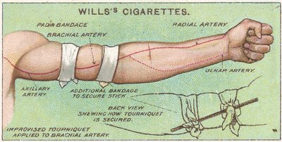 Tourniquet, nr 11 från First Aid-serien med Willss Cigarettes-kort, 1913 av English School