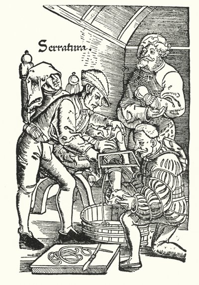 Amputation under sextonhundratalet (gravyr) av European School