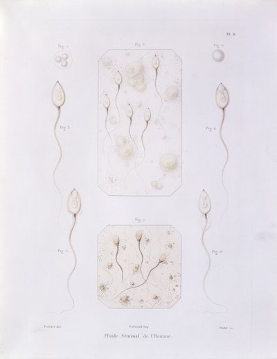 Seminalvätska, från Theorie Positive de lOvulation Spontanee et de la Fecondation des Mammiferes et de lEspece Humaine av Felix-Archimede Pouchet (1800-72) graverad av Oudet, Paris, 1847 (färgad eng. av Felix Archimede Pouchet