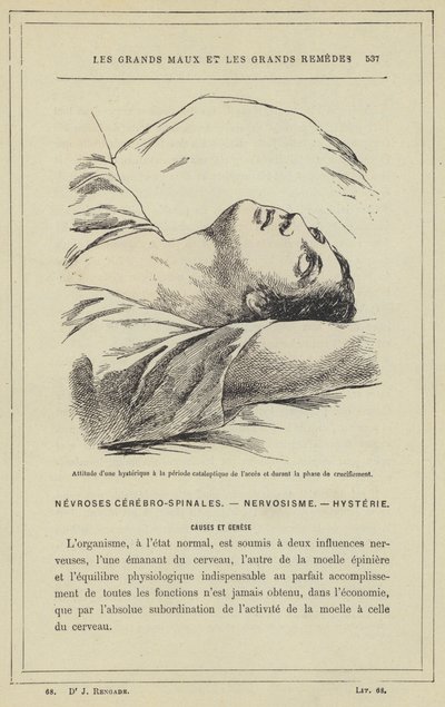 En hysterikers attityd under den kataleptiska perioden av tillträdet och under fasen av korsfästelsen (färg litho) av French School
