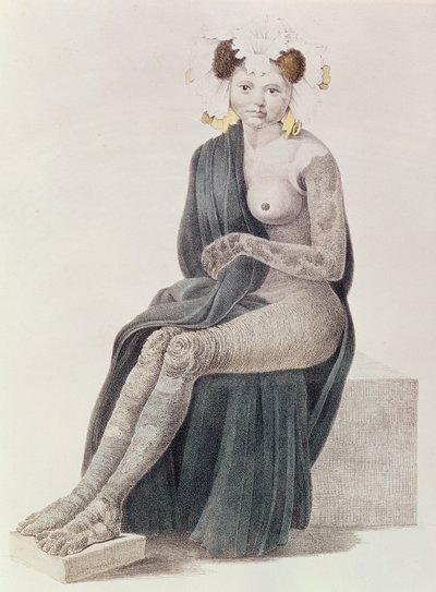 Congenital Ichthyosis, från en bok av G.M. Olbers, 1830 av French School