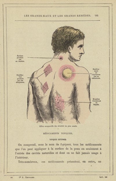 Jämförande effekter av de vanligaste repellenterna (färg litho) av French School
