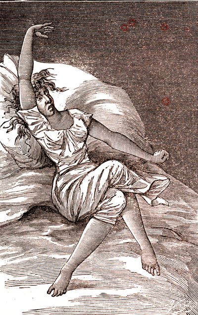 Huvudvärk, melankoli och hysteri, ångest. 1887 (gravyr) av French School