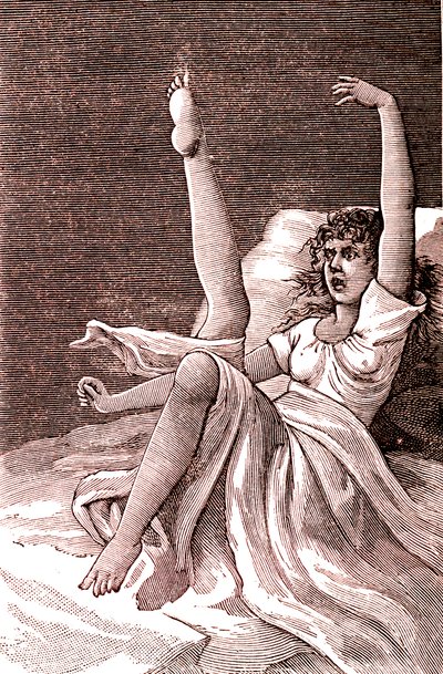 Hysteri, ett extremt mentalt fenomen, psykoser och psykoneuros.1887 (gravyr) av French School